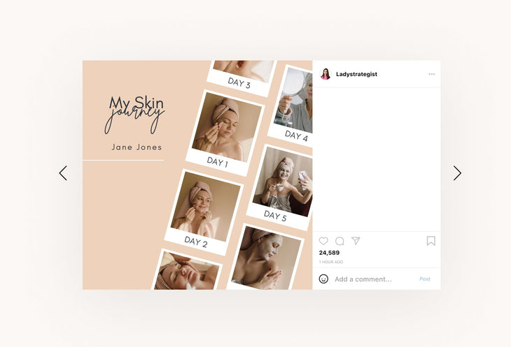 Ladystrategist 30 Skin Care Instagram Post Canva Templates instagram canva templates social media templates etsy free canva templates